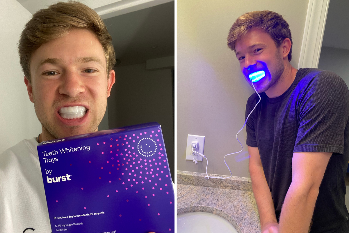 My Review of BURST’s Whitening Trays