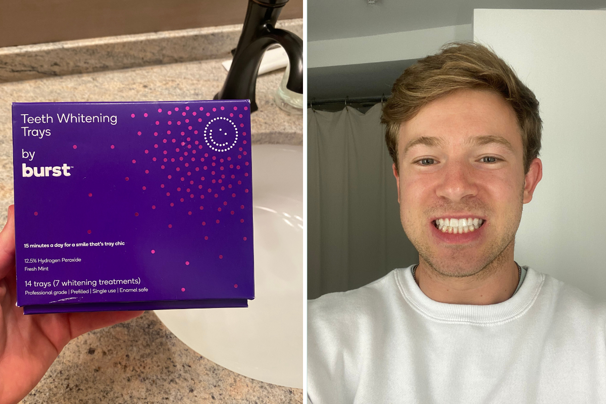 My Review of BURST’s Whitening Trays My Subscription Addiction