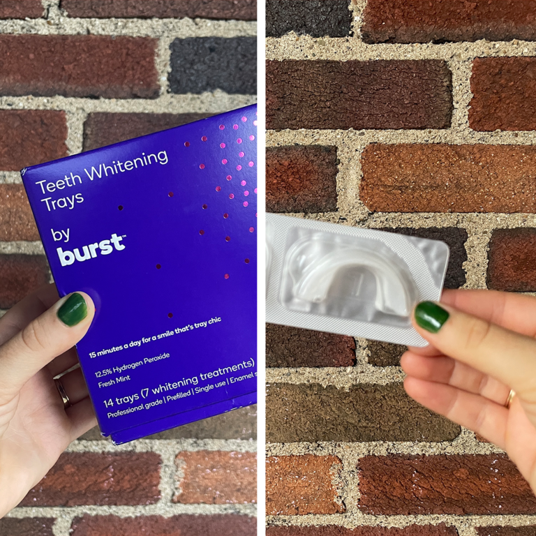 My Teeth Before and After Using Burst Whitening Trays Does it Really