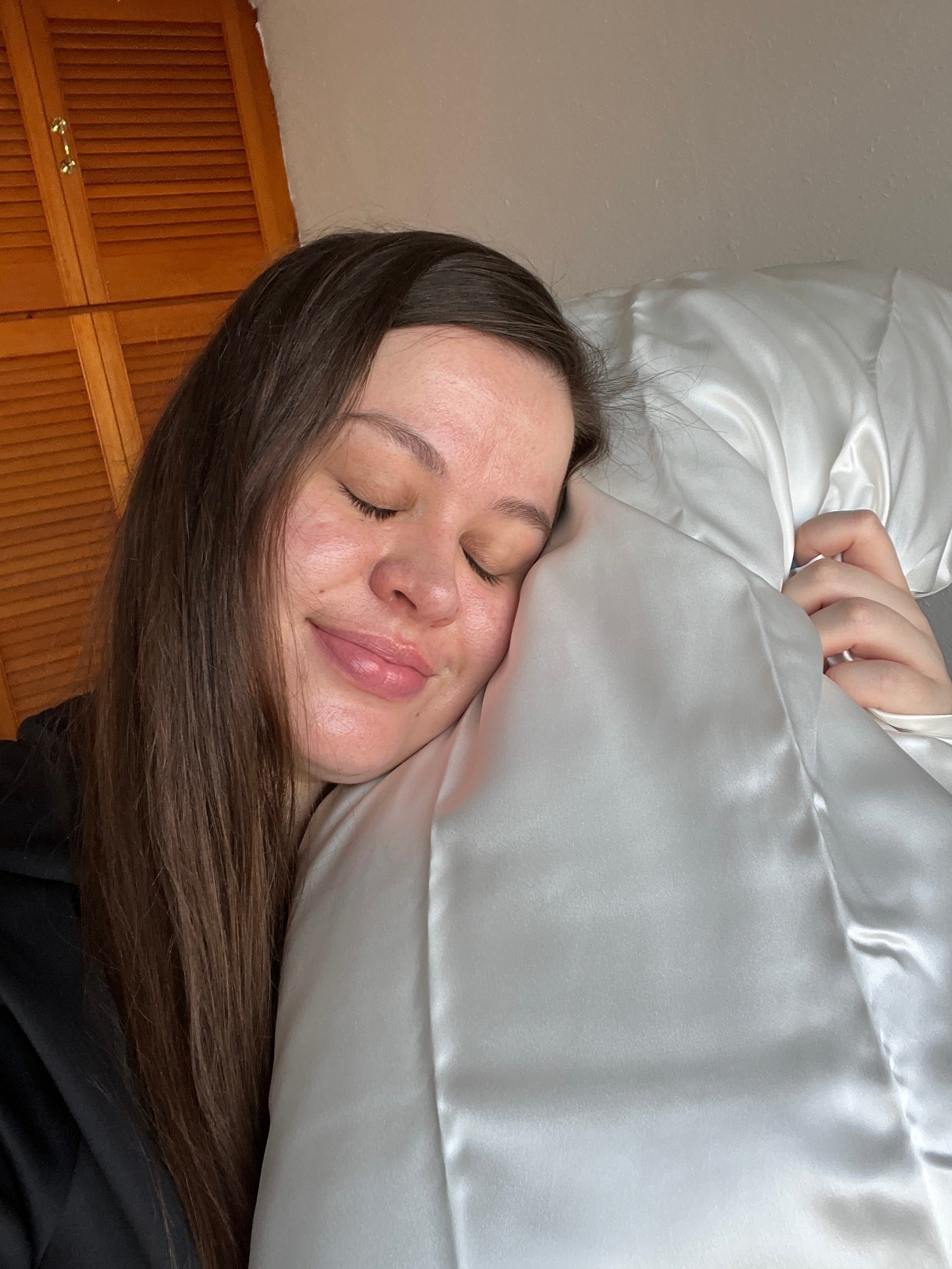 I Thought I Just Had Acne-Prone Skin – See How Silvi’s Anti-Acne Pillowcase Proved Me Wrong