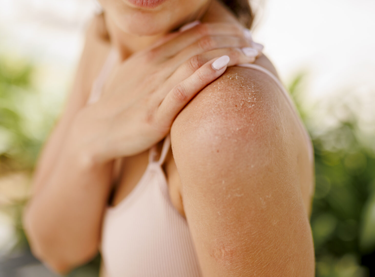 4 Signs You Might Have Keratosis Pilaris (KP) and How to Fix It My