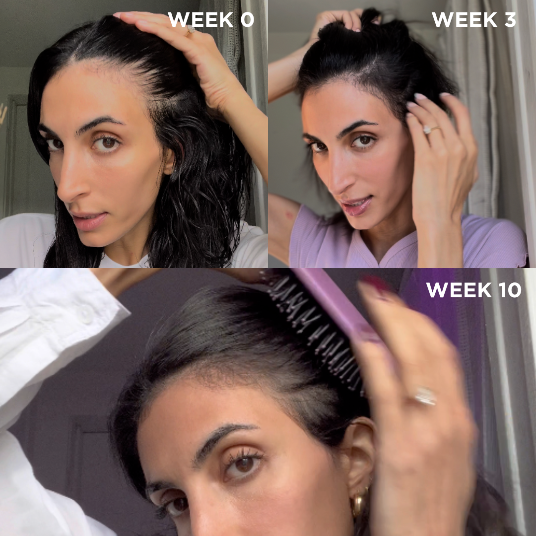 Get Thicker Looking Hair in Three Weeks With This Purity Products Deal