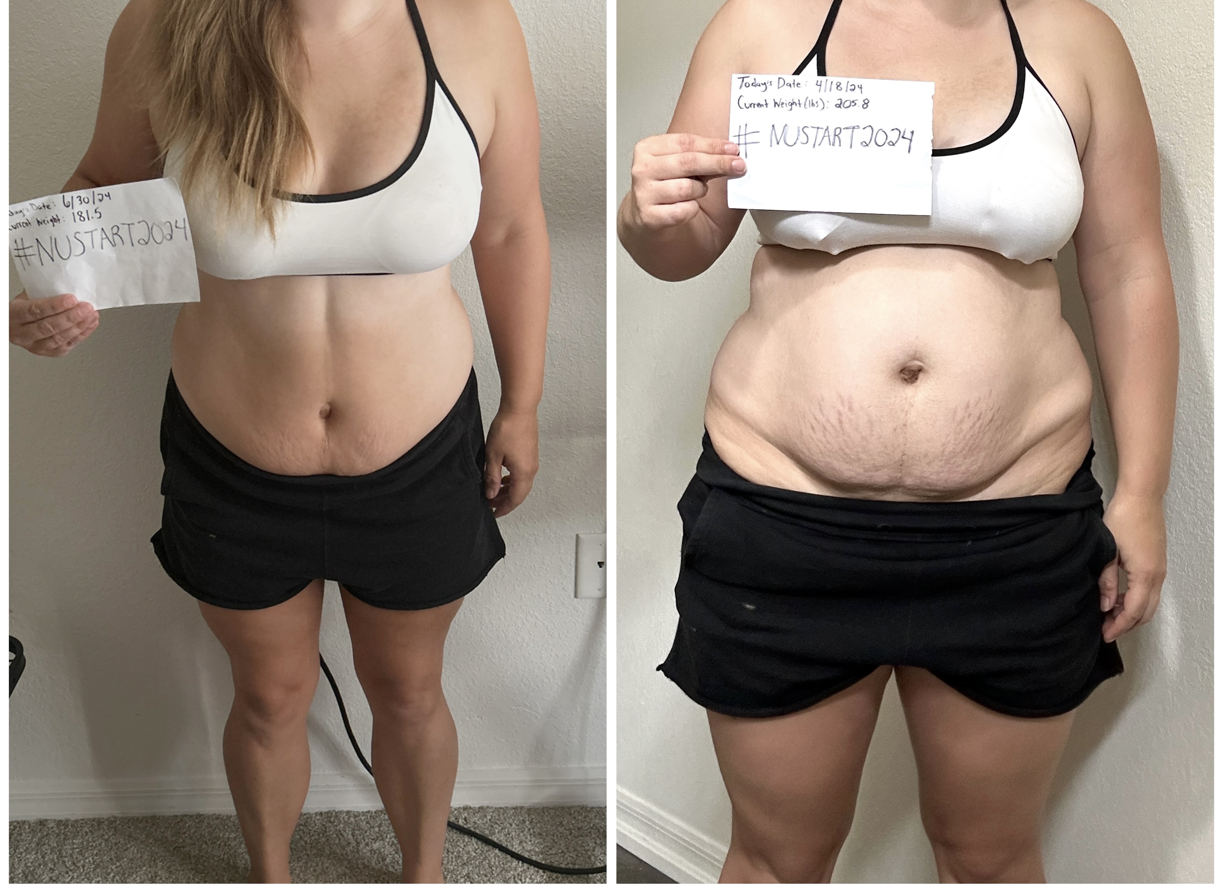 I Got My Health Insurer To Pay For My Weight Loss – And It Was Free